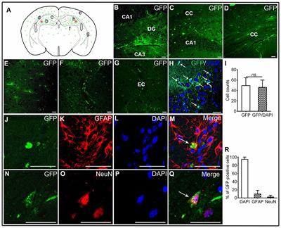 Human Neural Stem Cell Transplantation Rescues Cognitive Defects in APP/PS1 Model of Alzheimer’s Disease by Enhancing <mark class="highlighted">Neuronal Connectivity</mark> and Metabolic Activity